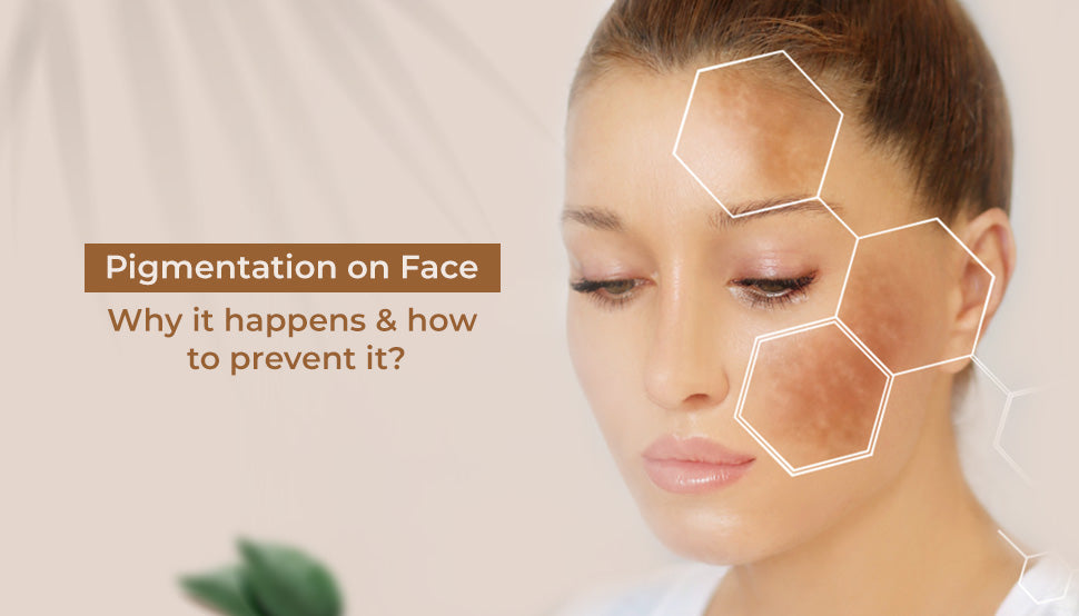 Pigmentation on Face: Why It Happens and How to Prevent It?