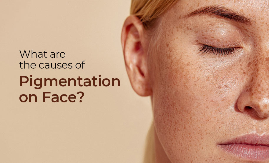 What Are the Causes of Pigmentation on Face?