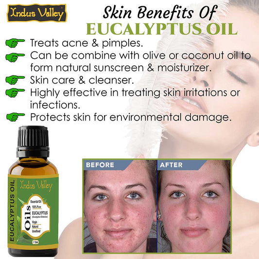 Pure  Eucalyptus Essential Oil 